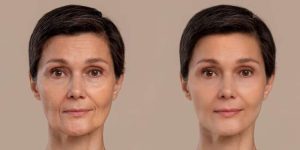 Tips Menghindari Penuaan Dini Pada Kulit