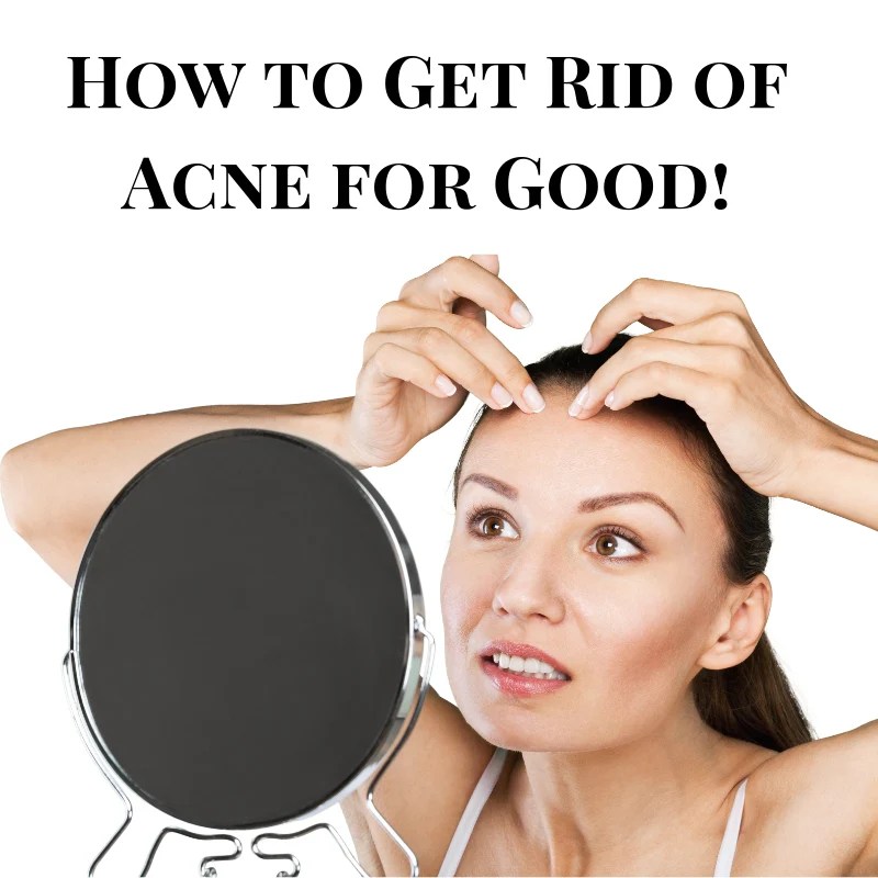 Acne back rid get remedies fast natural treatment skin top pimples treat top10homeremedies why many scars cystic here severe people Acne back rid get remedies fast natural treatment skin top pimples treat top10homeremedies why many scars cystic here severe people