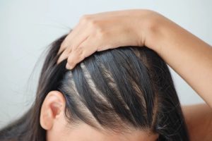 Tips Merawat Rambut Tipis agar Terlihat Lebih Bervolume