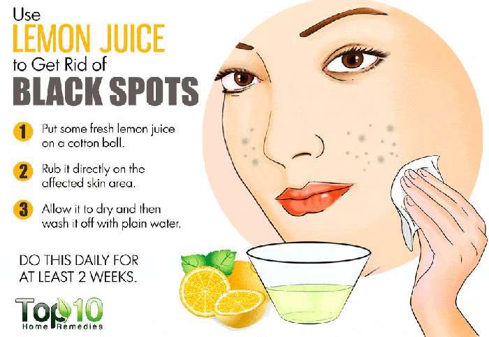 Spots lemon dark face remedies rid get juice marks skin pimples remove spot use tips acne clear treatment pimple natural
